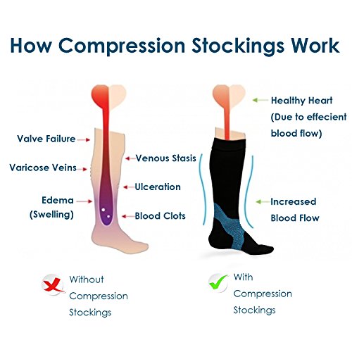 Compression Socks - 50% Off Special